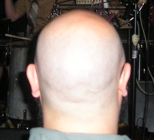 The back of a bald man's head